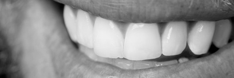 Remplacer-une-dent-absente Dentiste Montélimar