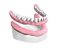 Appareil-resine-complet Dentiste Montélimar